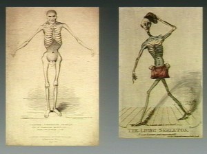 Seriously, looking like this does not help you dance better. Source: This file comes from Wellcome Images, a website operated by Wellcome Trust, a global charitable foundation based in the United Kingdom.  Licensed under Creative Commons 4.0.